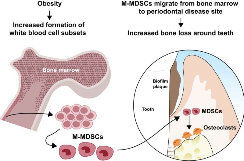 Obesity raises the risk of gum disease by inflating growth of bone-destroying cells