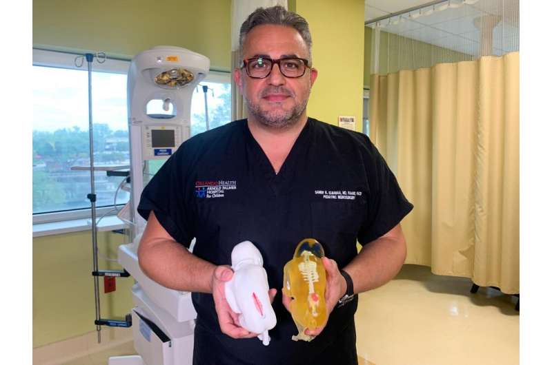 Orlando Health surgeons use 3D-printed fetus models to prepare for in-utero procedure