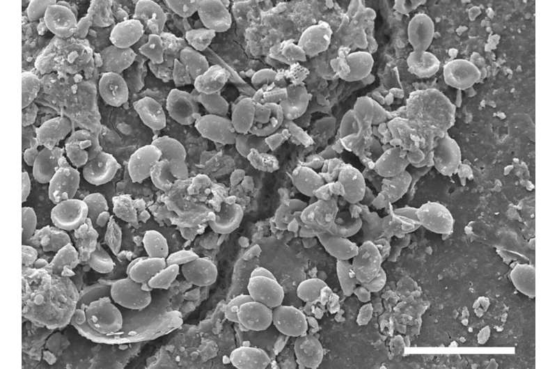 Pathogenic fungi colonise microplastics in soils