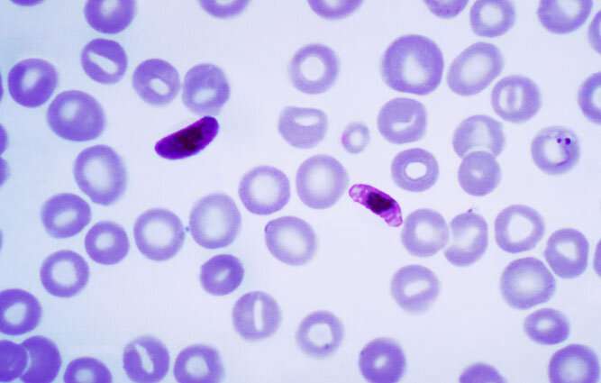 Plasmodium falciparum evolving to escape malaria rapid diagnostics in Africa