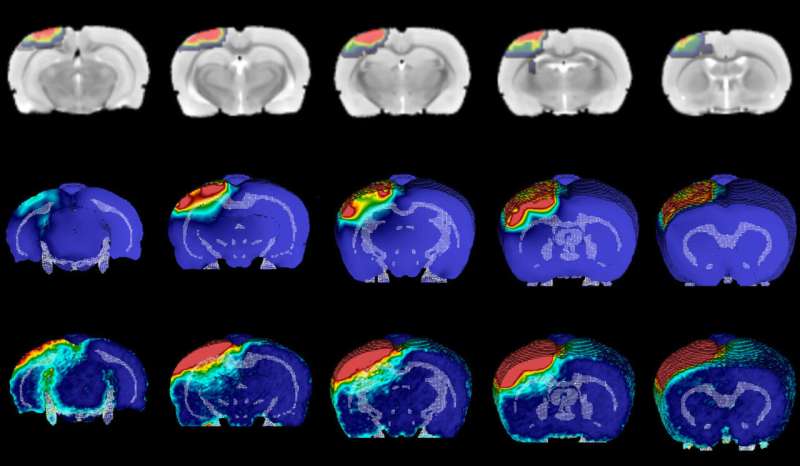 Precise mapping shows how brain injuries inflict long-term damage
