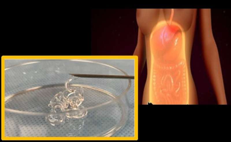 Preventing postsurgical adhesions using hydrogel barriers
