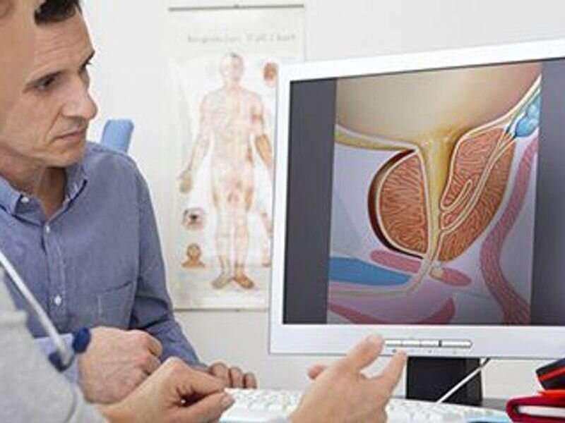 Prostate cancer screening declined following 2012 USPSTF guidance