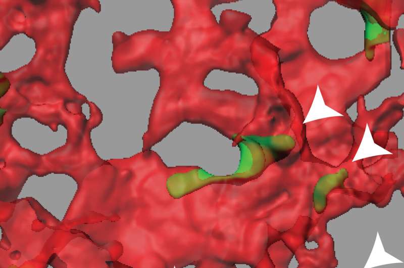 Protein appears to prevent tumor cells from spreading via blood vessels