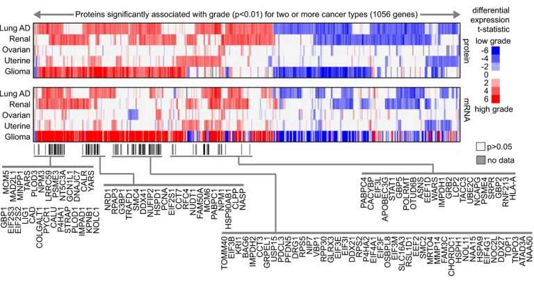Proteomics analysis identifies potential drug targets for aggressive human cancers