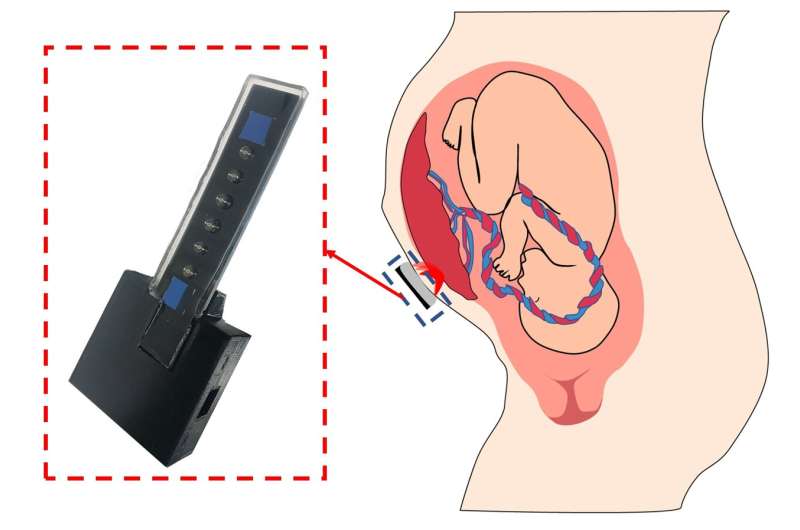 Prototype may diagnose common pregnancy complications by monitoring placental oxygen