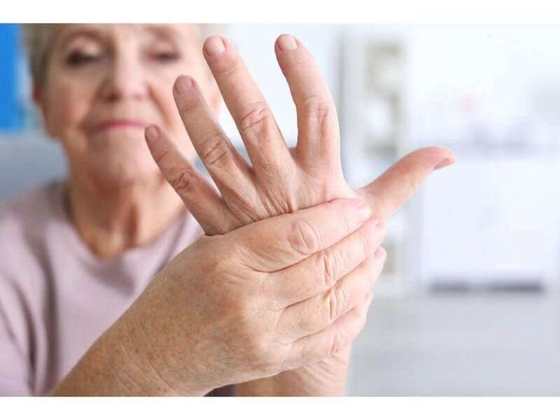 Rheumatoid arthritis predictors found in undifferentiated large joint  arthritis