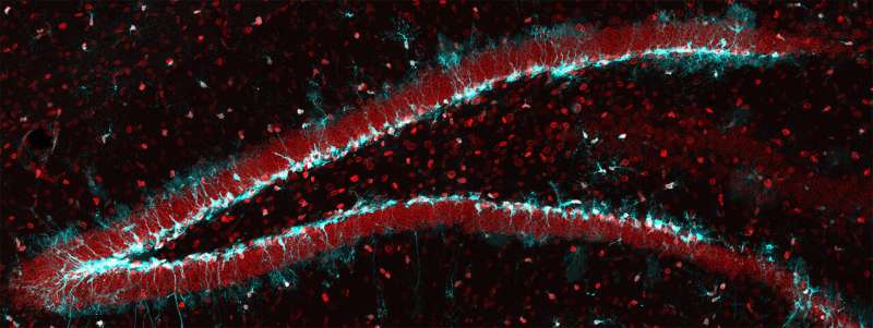 Reactivating aging stem cells in the brain