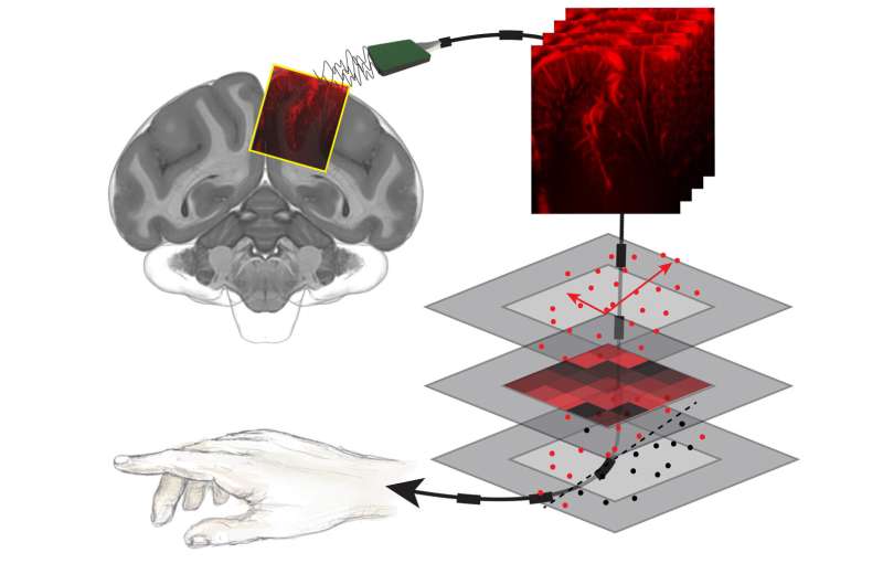 Reading minds with ultrasound: A less-invasive technique to decode the brain's intentions