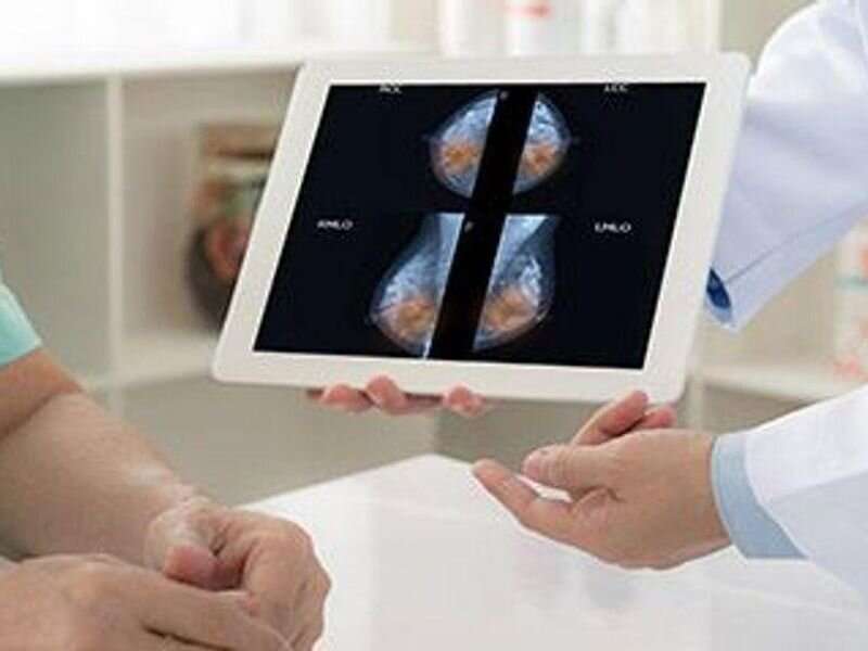 Real-time mammography reading cuts disparities in diagnostic imaging
