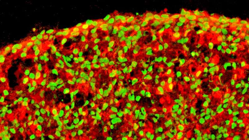 Research advances one step closer to stem cell therapy for type 1 diabetes