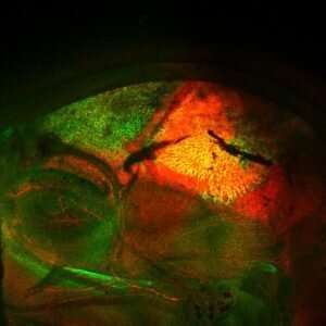 Research into skull birth defect detailed by USC-Oxford team