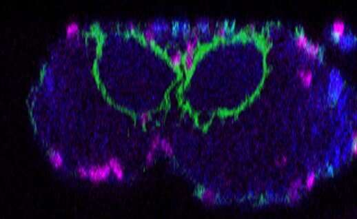 Researchers detect a diffusion barrier inside fly brain