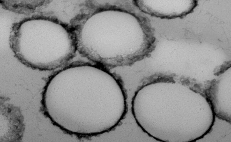 Researchers develop magnetised nanobeads to detect early-stage cancer