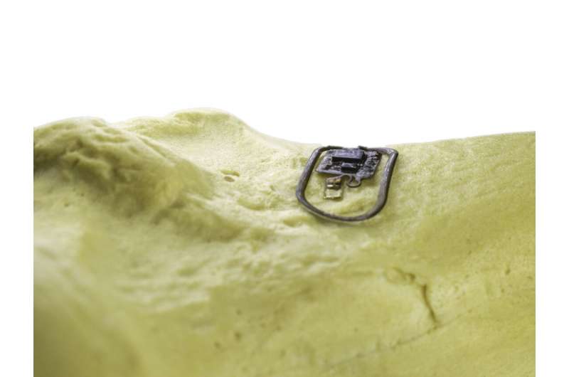 Researchers develop ultra-thin 'computer on the bone'