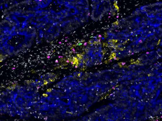 Researchers discover immune cell “hubs” hiding in tumors
