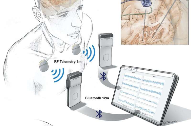 Researchers wirelessly record human brain activity during normal life activities
