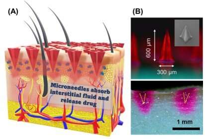 Rethinking how drugs are administered: A breakthrough in microneedle patches