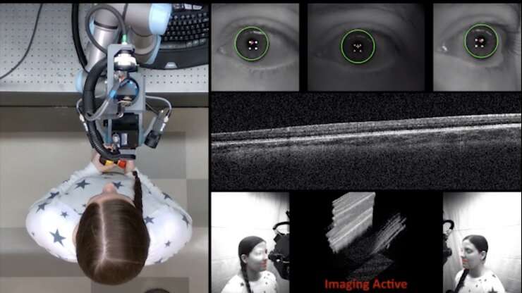 Robotic scanner automates diagnostic imaging in the eye