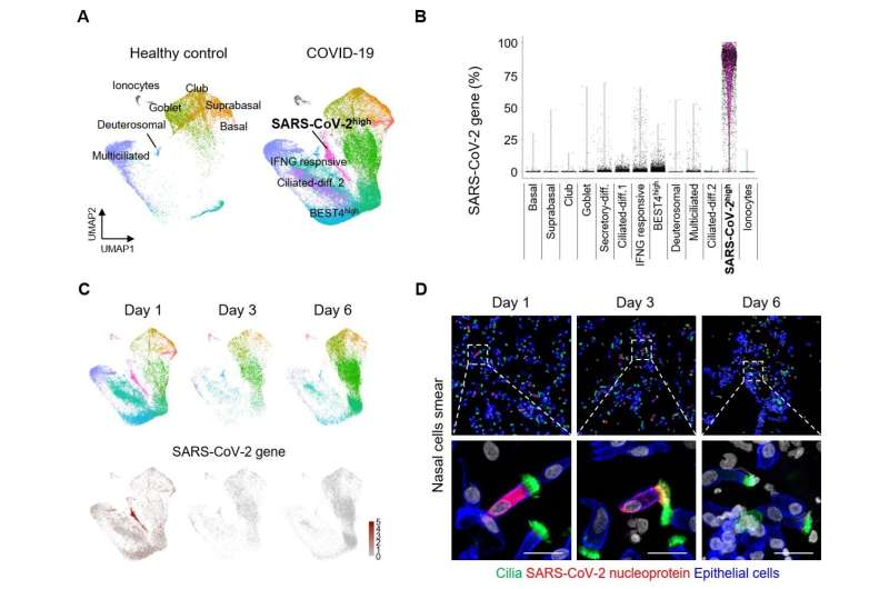 SARS-CoV-2 replication targets nasal ciliated cells early in COVID-19 infection