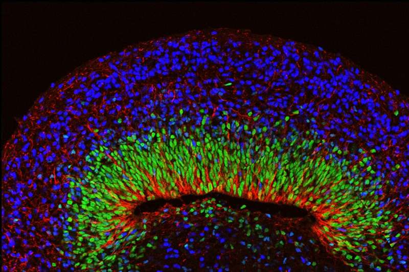 Scientists develop brain organoids with complex neural activity