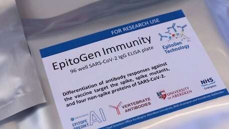 Scientists develop 'game-changing' antibody test