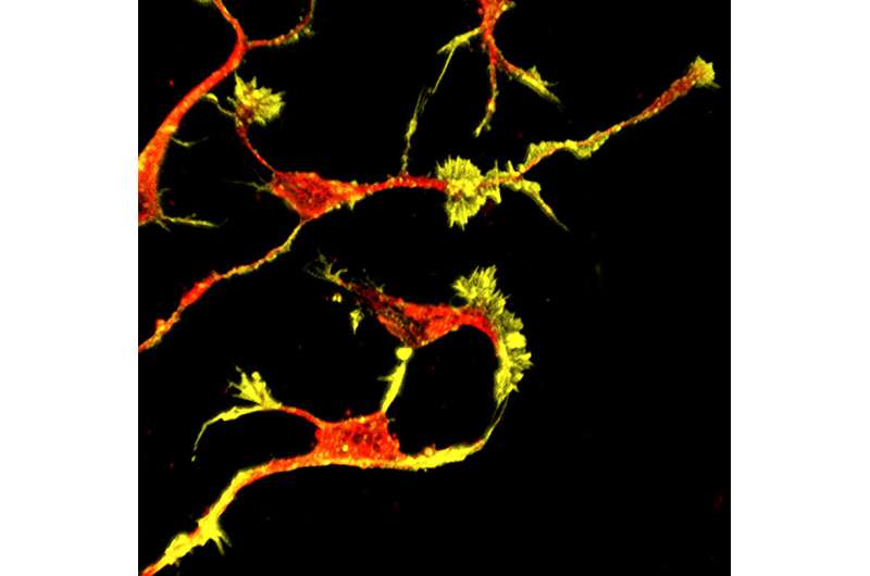 Scientists discover biological mechanisms caused by deficits in high-risk autism gene