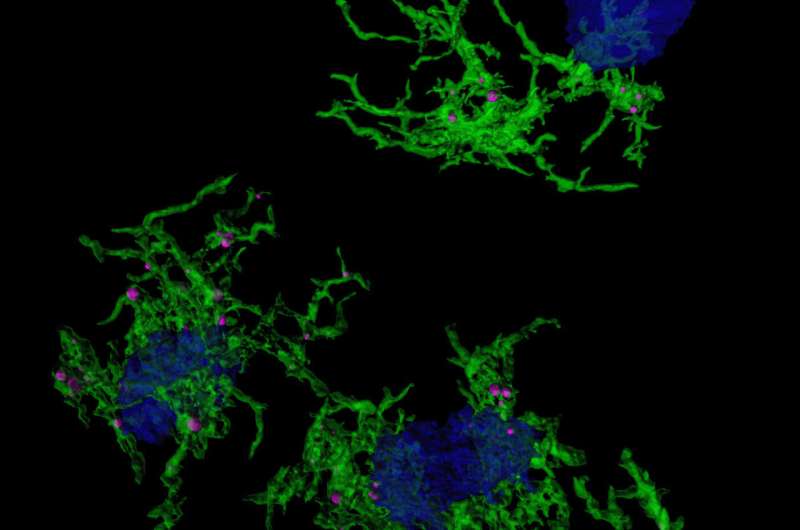 Scientists discover gene signature responsible for plaque-eating microglia in Alzheimer’s Disease