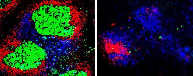 Scientists find new details about how immune system builds long-term memory