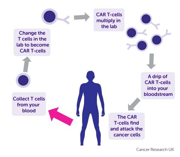 Scientists trial new way to boost CAR T-cell therapy