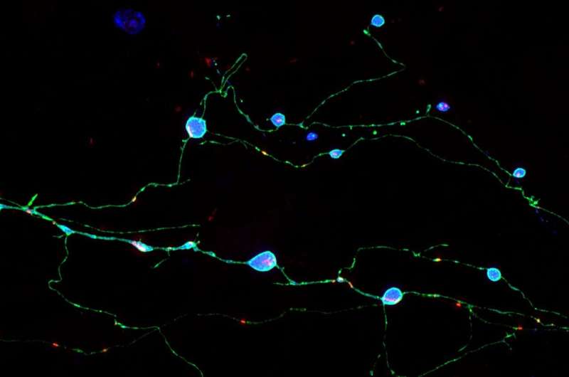 Scripps Research discovery illuminates how brain cells die in prion diseases