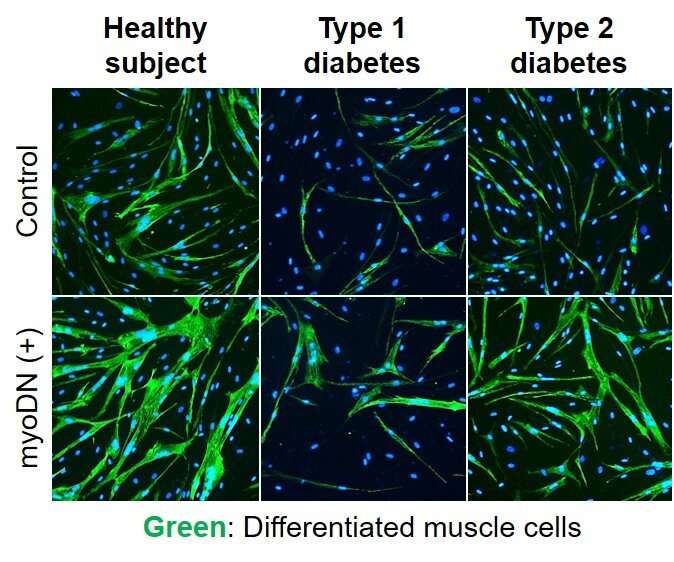 Skeletal muscle loss exacerbated by diabetes improved with oligo DNA