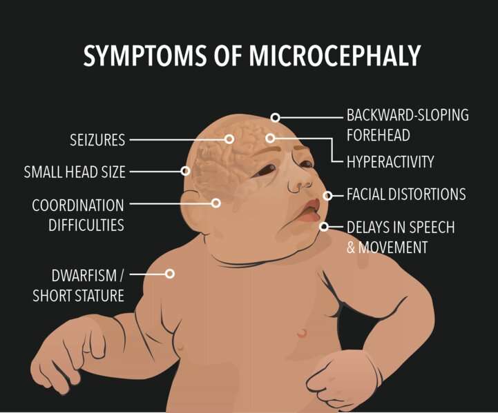 Slowed cell division causes microcephaly