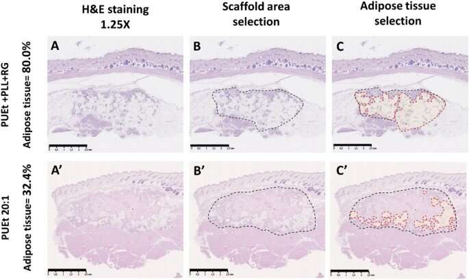 Soft tissue regeneration in a cell-free scaffold microenvironment