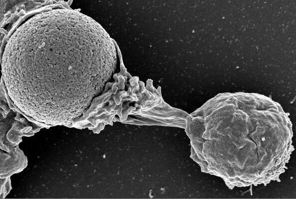 Squishy white blood cells quickly become highly stiff and viscous in response to a threat
