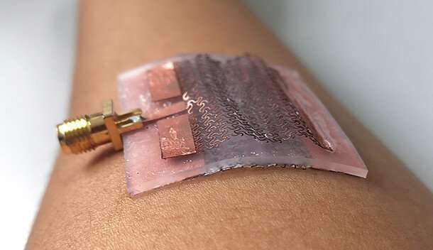 Stretching the boundaries of medical tech with wearable antennae