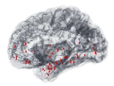 مطالعه پویایی عصبی مدیتیشن ذهن آگاهی و هیپنوتیزم را بررسی می کند 