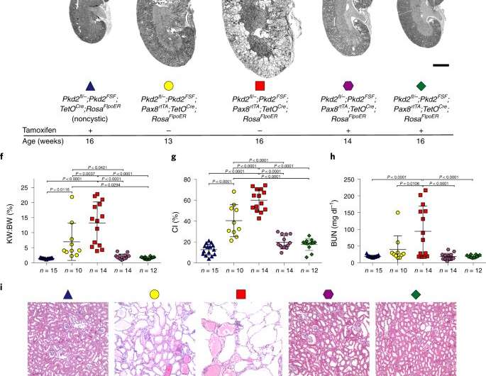 Study: Genetic kidney disorder reversible in preclinical models