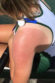 Study recommends better sun protection for young rowers during competition