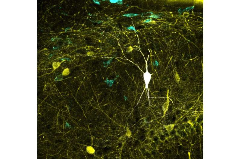 Study upgrades one of the largest databases of neuronal types