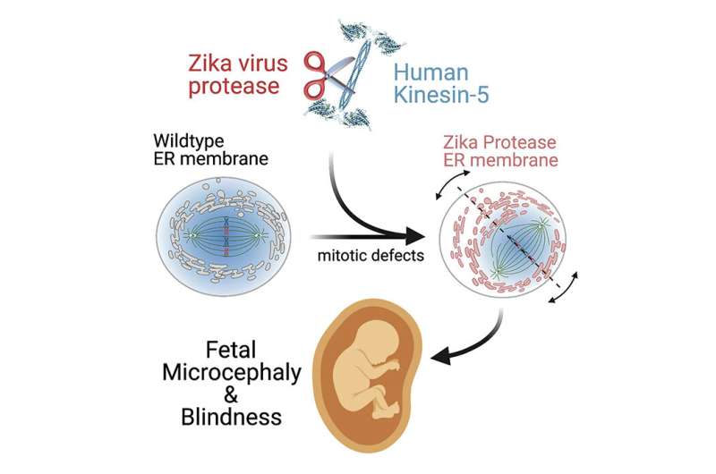Study discovers source of Zika neurodevelopmental defects