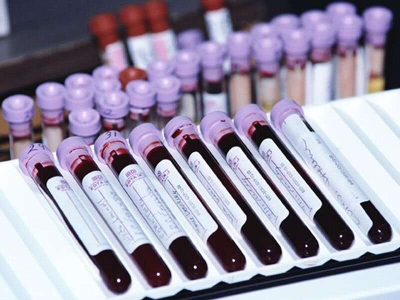 Study refutes theory that blood type affects COVID risk