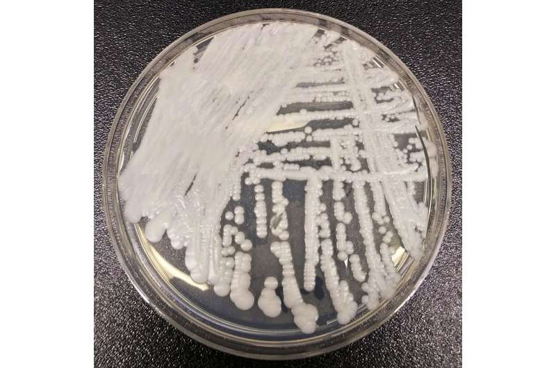 'Superbug' fungus spread in two cities, health officials say