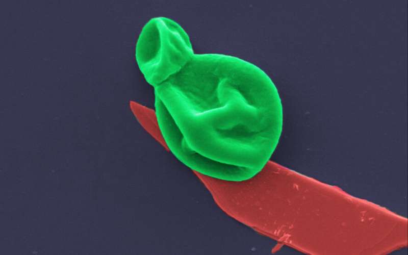 Superbug killer: New nanotech destroys bacteria and fungal cells