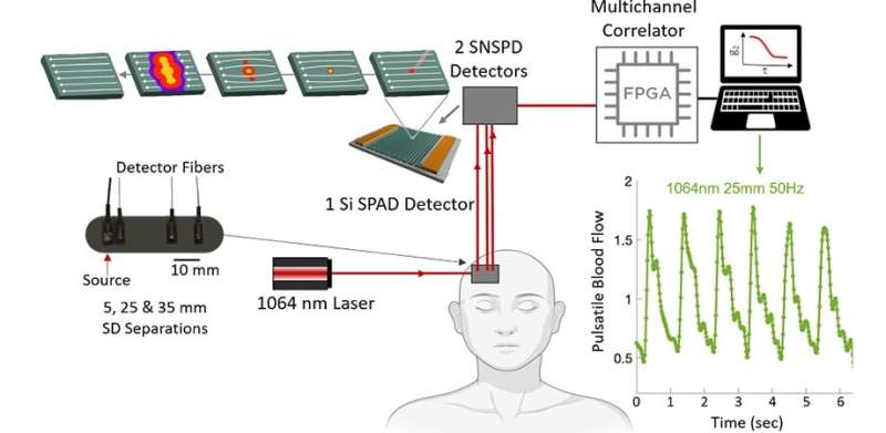 Supergeleidende nanodraad-single-photon-detectoren: het volgende grote ding in bloedstroommeting