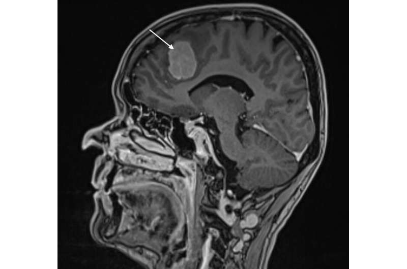 Surgical treatment of brain tumours should also be considered for the elderly
