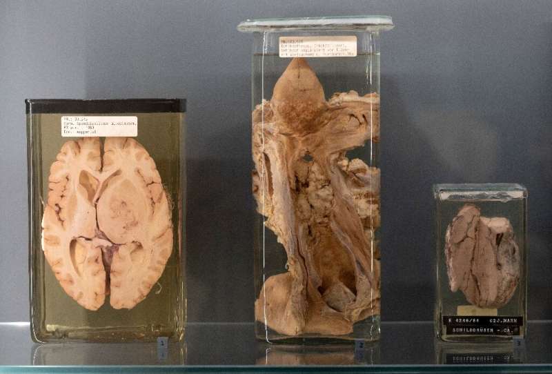 The collection of around 50,000 human body parts at Vienna's Natural History Museum was first conceived in 1796 to help train me
