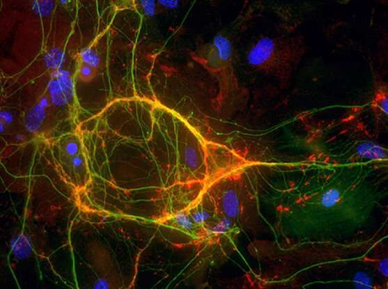 The origin of of two neuron types reveals how some cellular diversity emerges in the brain