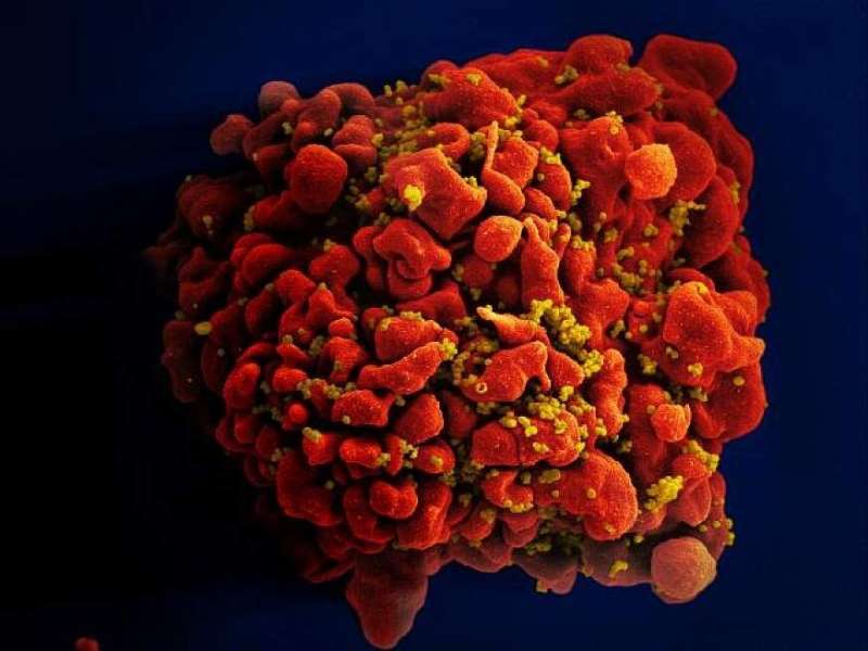 This handout photo made available by the National Institutes of Health shows a human white blood cell infected with HIV virus