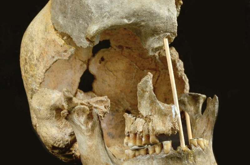 This handout picture released on April 7, 2021, by the National Museum of Prague shows the skull of a modern human female indivi